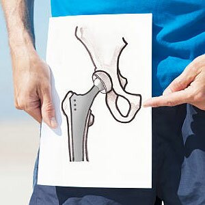 joint replacement surgeon in vijayawada